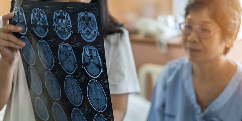 An elderly woman is shown the brain x-ray report by a doctor