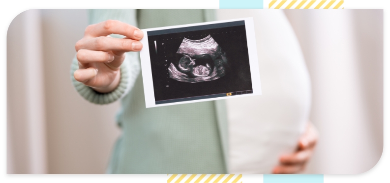 The belly of a pregnant woman seen from the side as the woman holds and poses her fetal sonogram